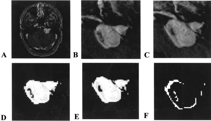 Fig 6.