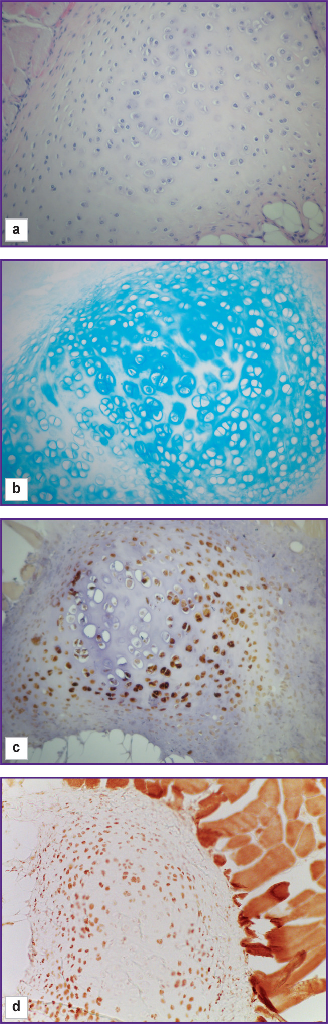 Figure 14.