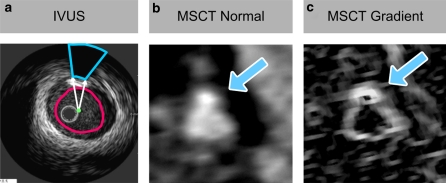 Fig. 2