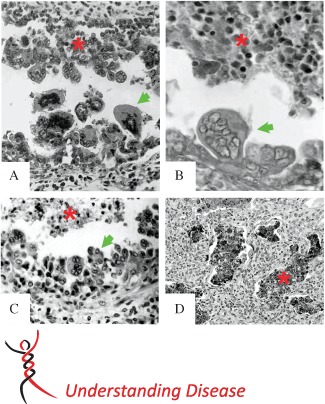 PATH-4462-FIG-0001-c