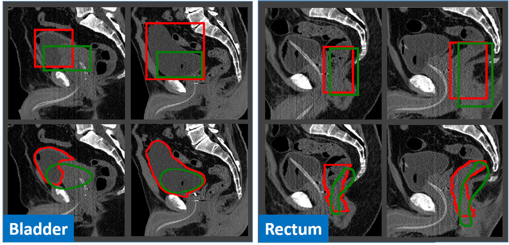 Fig. 11