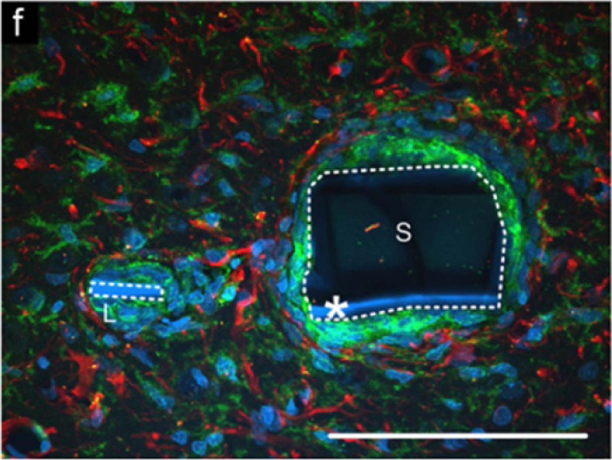 Figure 35.