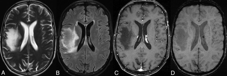 Fig 3.