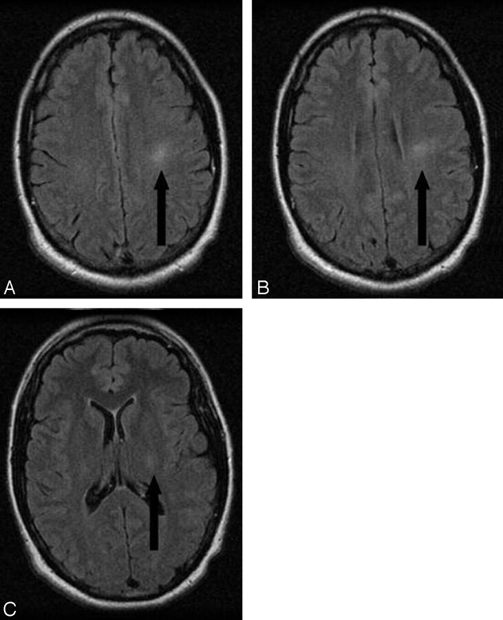 Fig 1.