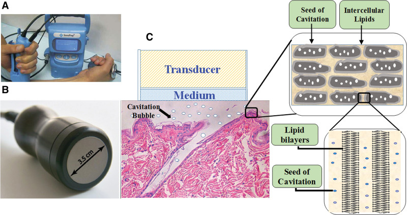 Figure 4.