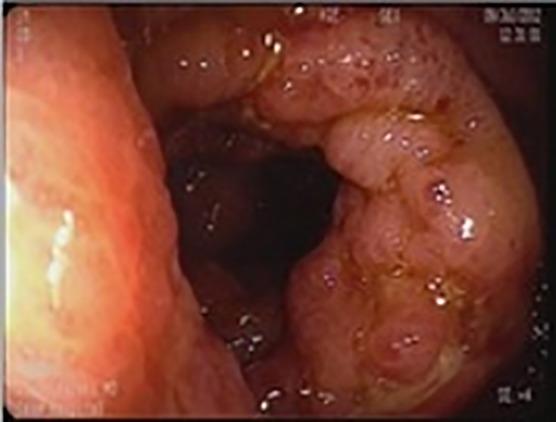 Fig.1c