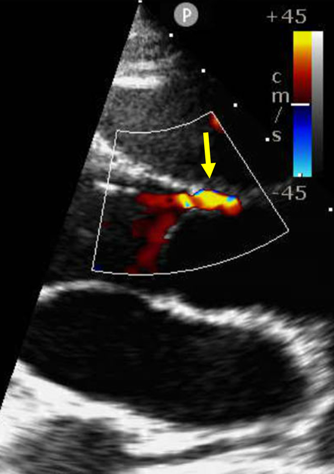 Figure 2