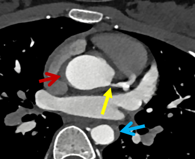 Figure 3