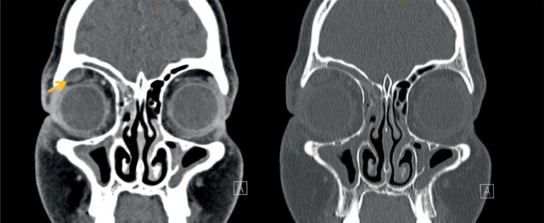 Figure 3b