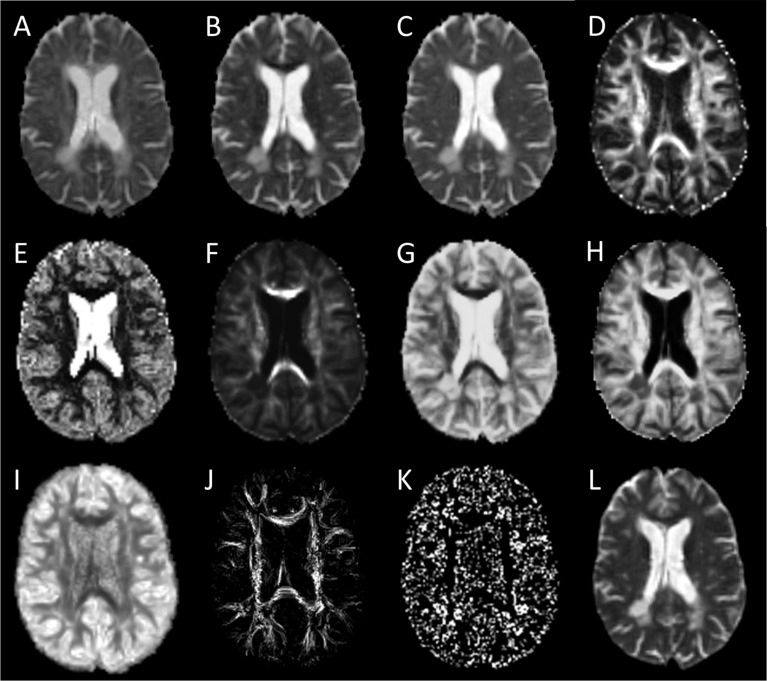 FIGURE 2