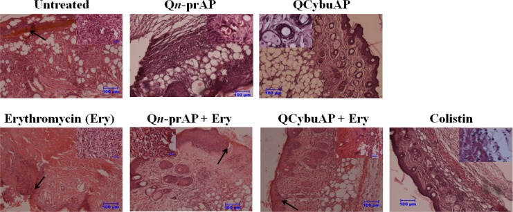 Fig 12