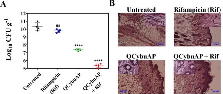 Fig 13