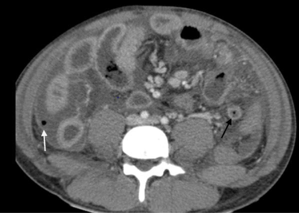 Fig. 2