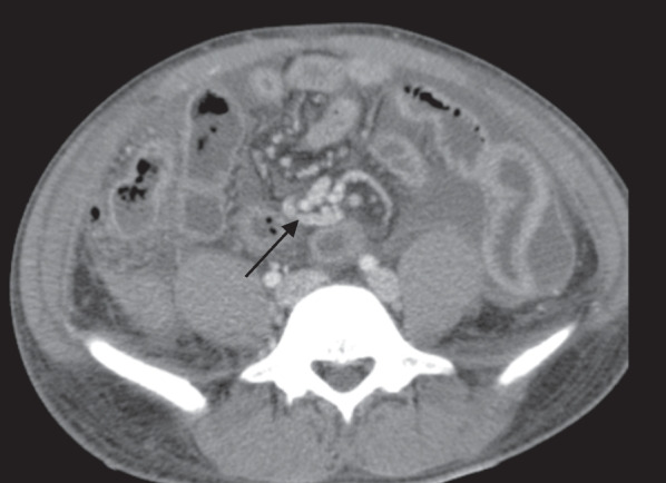 Fig. 4