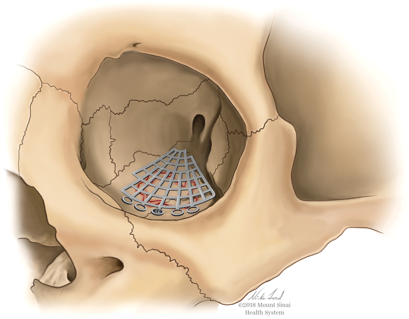 Fig. 2