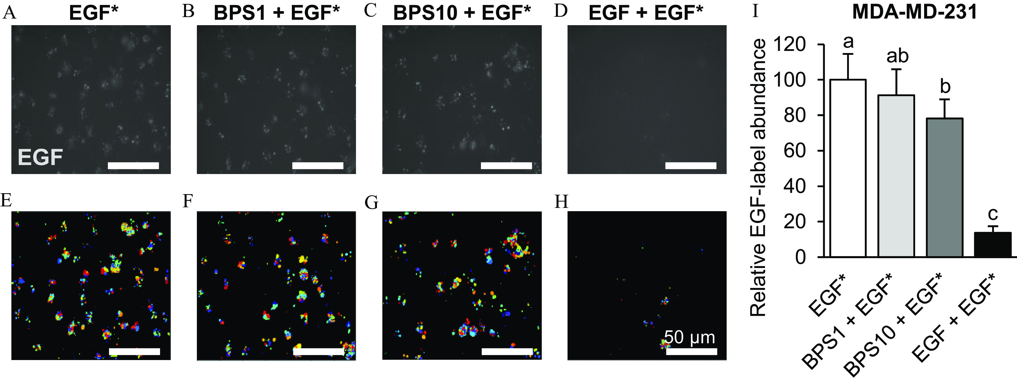 Figures 5A, 5B, 5C, 5D, 5E, 5F, 5G, and 5H are a set of internalization images of M D A-M D-231 cells, and Figure 5I is a bar graph. In Figures 5A, 5B, 5C, 5D, 5E, 5F, 5G, and 5H, images of M D A-M D-231 cells showing the effects of bisphenol S on epidermal growth factor with 50 micrometers are presented. Epidermal growth factor is exposed to 100 nanograms per alexa fluor 647-labeled epidermal growth factor (Figure 5A,E); bisphenol S plus epidermal growth factor is exposed to 1 microgram per milliliter bisphenol S plus 100 nanograms per milliliter epidermal growth factor (Figure 5B,F); bisphenol S 10 plus epidermal growth factor is exposed to 10 micrograms per milliliter bisphenol S plus 100 nanograms per milliliter epidermal growth factor, (Figure 5C,G);and epidermal growth factor plus epidermal growth factor is exposed to 100 nanograms per milliliter non-labeled epidermal growth factor plus 100 nanograms per milliliter epidermal growth factor (Figure 5D,H). The cells were exposed for 5 minutes. In Figure 5I, the bar graph titled M D A-M D-231 plots relative epidermal growth factor-label abundance, ranging from 0 to 120 in increments of 20 (y-axis) across epidermal growth factor, bisphenol S 1 plus epidermal growth factor, bisphenol S 10 plus epidermal growth factor, and epidermal growth factor plus epidermal growth factor (x-axis).