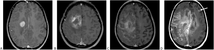 FIGURE 1