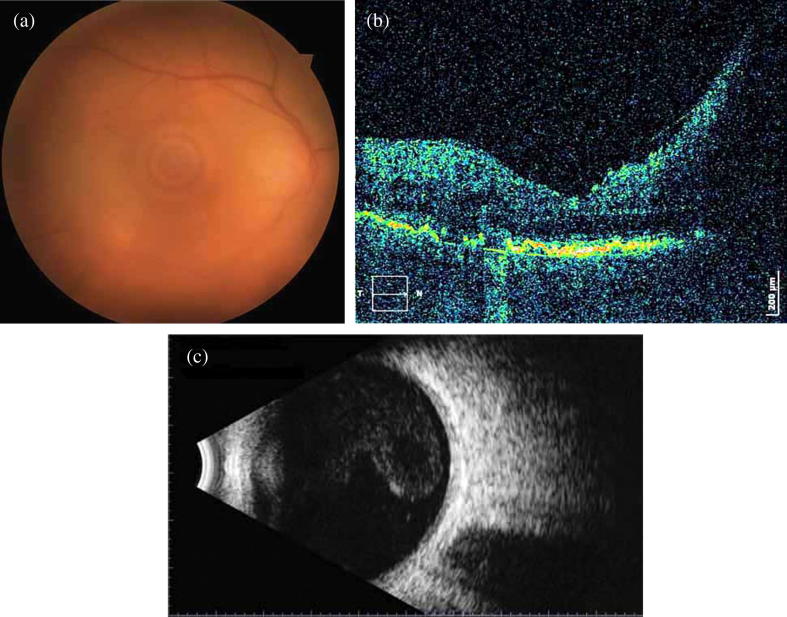 Fig. 1