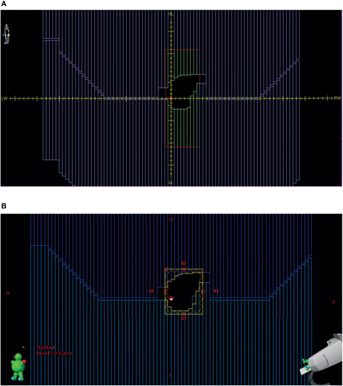 Figure 2