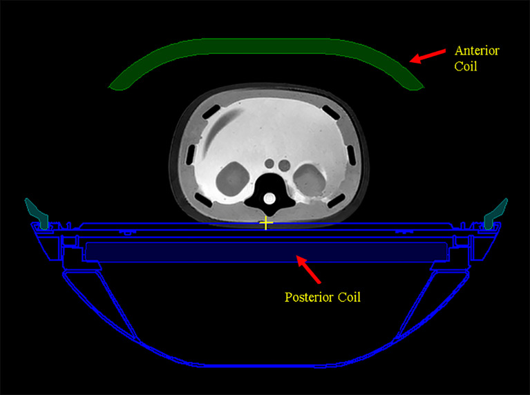 Figure 3