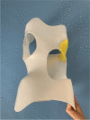 Fig. 1