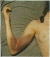 107