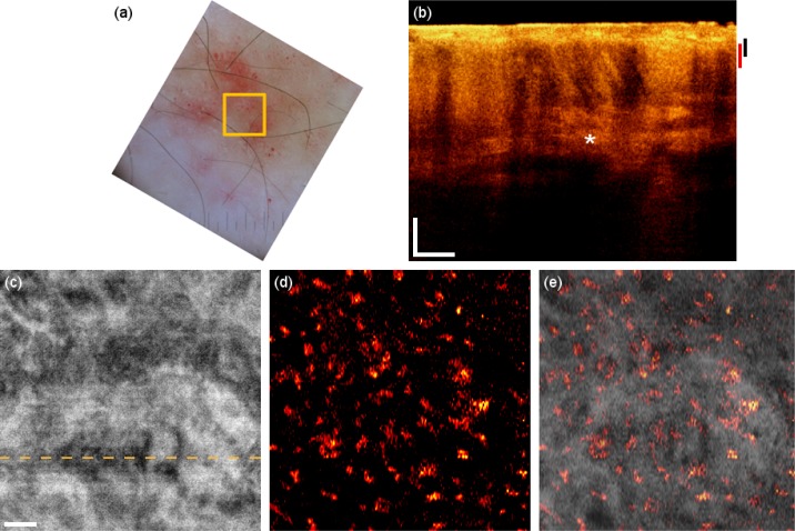 Fig. 3