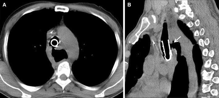 Fig. 2