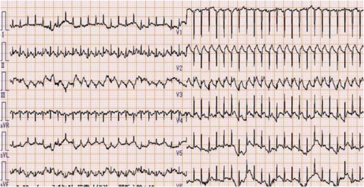 Fig. 1