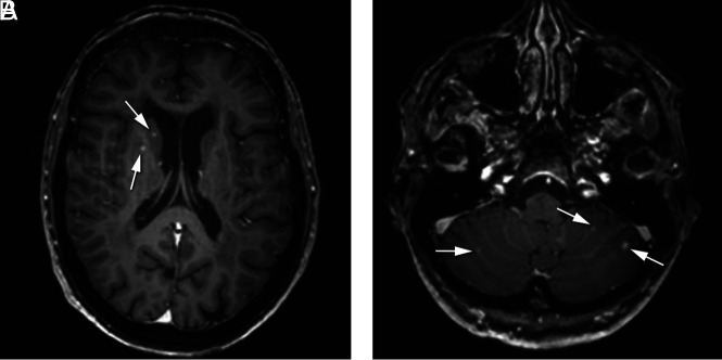 FIG 2.