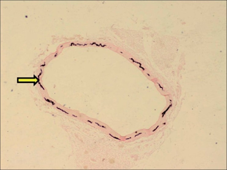 Figure 15