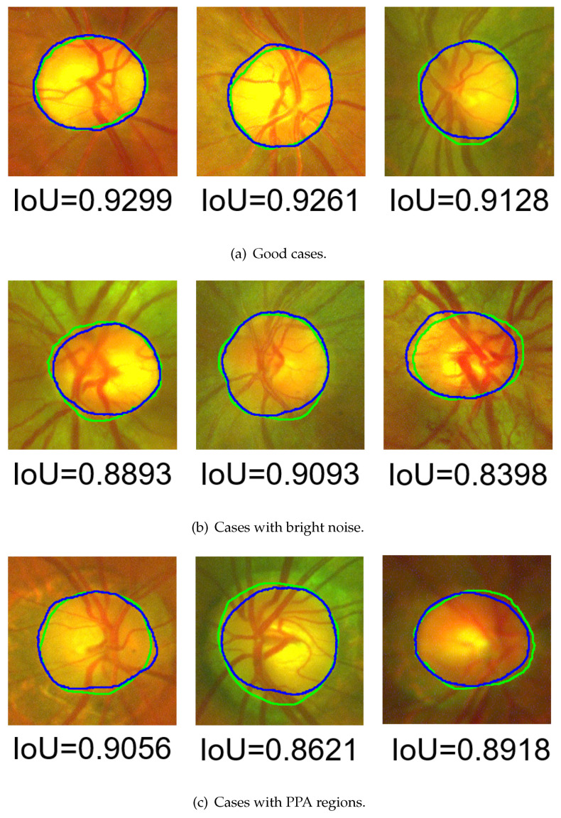 Figure 24