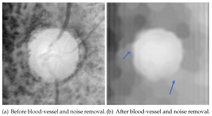 Figure 15