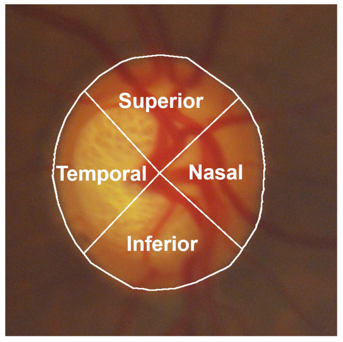 Figure 22