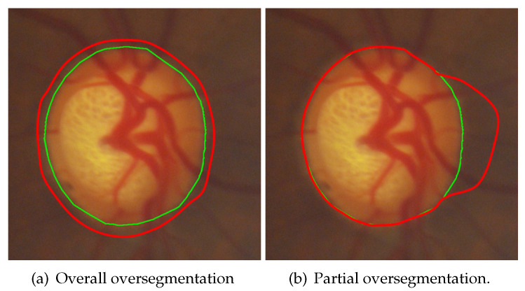 Figure 21