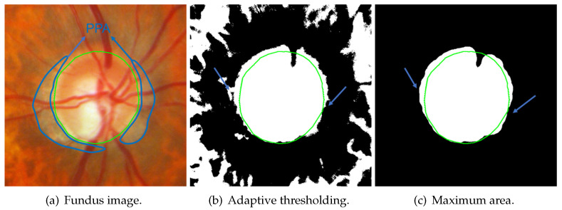 Figure 18