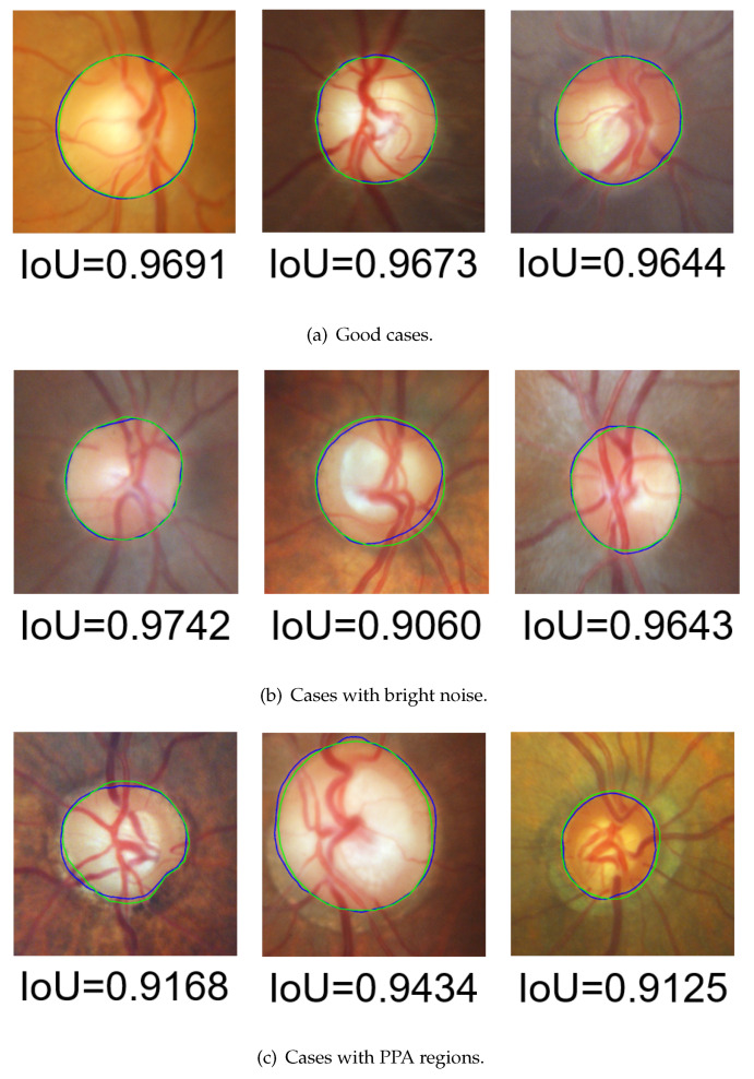 Figure 23