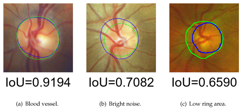 Figure 25