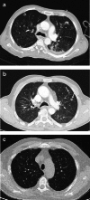 Fig. 9