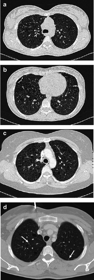 Fig. 11