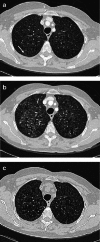 Fig. 10