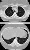 Fig. 12