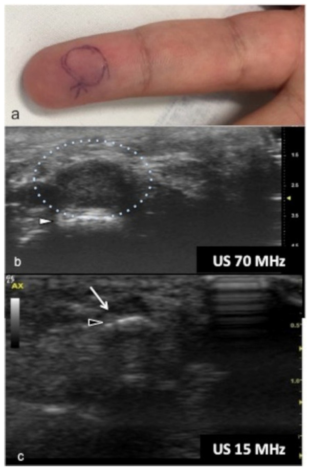 Figure 11