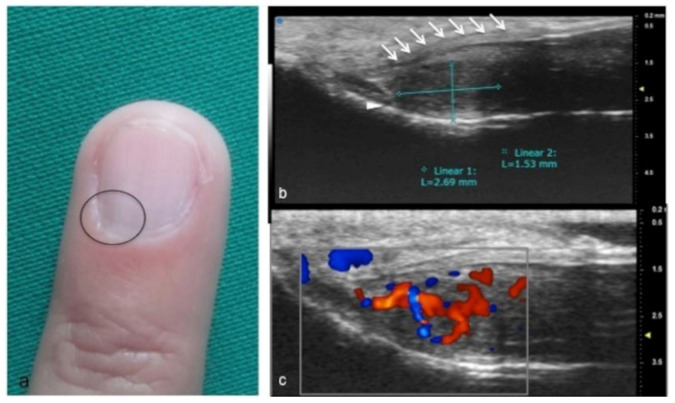 Figure 12