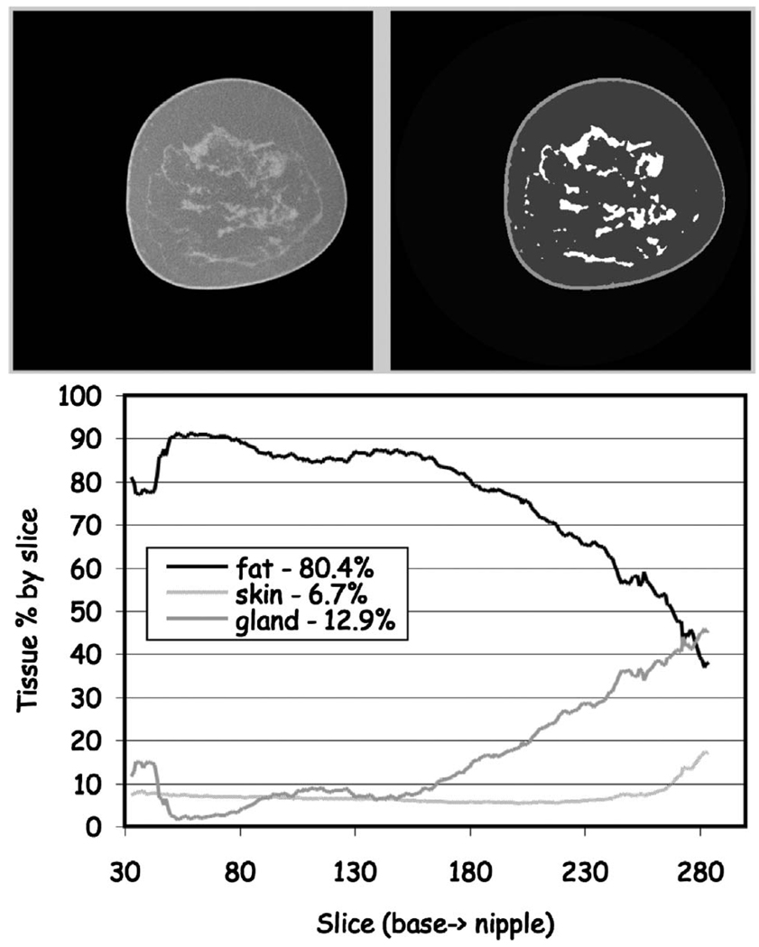 FIG 14