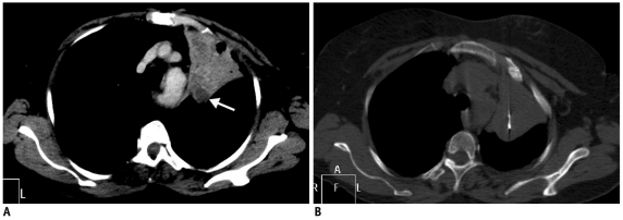 Fig. 24