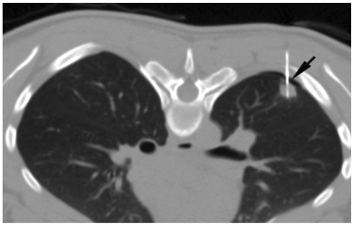 Fig. 11