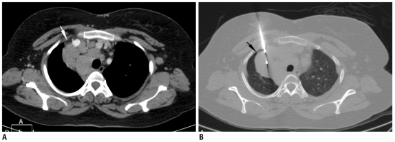 Fig. 19