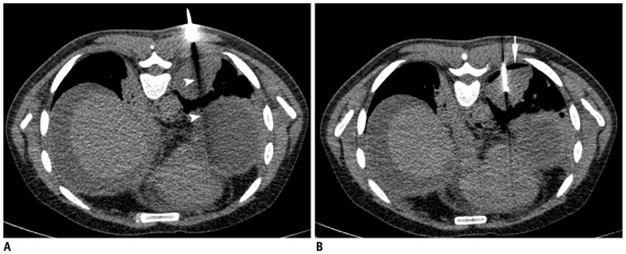 Fig. 28