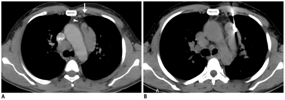 Fig. 21